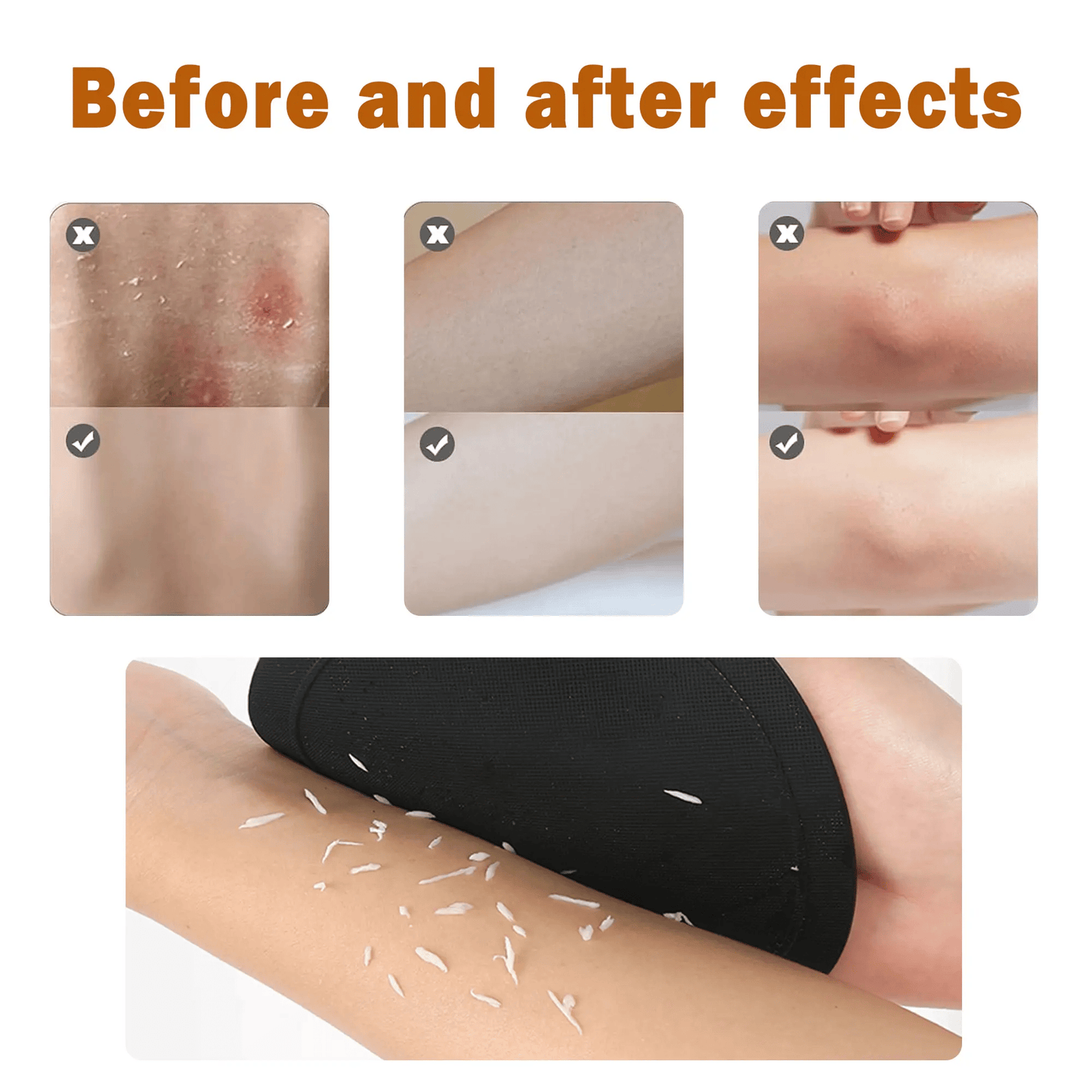 🎁Last Day - Buy 1 Get 1 Free🎉4-in-1 Exfoliating Scrubber Set | Reveal Silky Smooth Skin In Every Shower