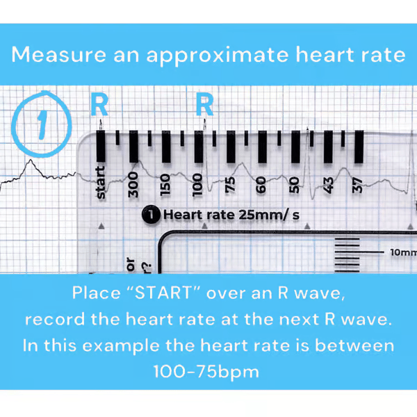 ECG 7 Step Ruler