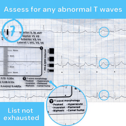 ECG 7 Step Ruler