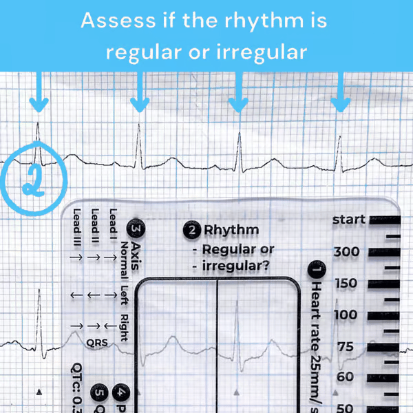 ECG 7 Step Ruler