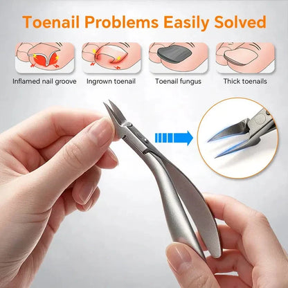 Stainless Steel Ingrown Toenail Clipper Set – Precise, Sturdy, Portable ✨