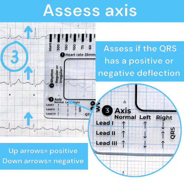 ECG 7 Step Ruler