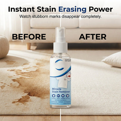 🏆Limited Time Promotion 49% OFF❄️Miracle Stain Remover Spray